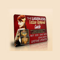 Laserlesstattooremoval Promotion Codes